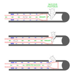 nucleotome-cutting-action-Color-5
